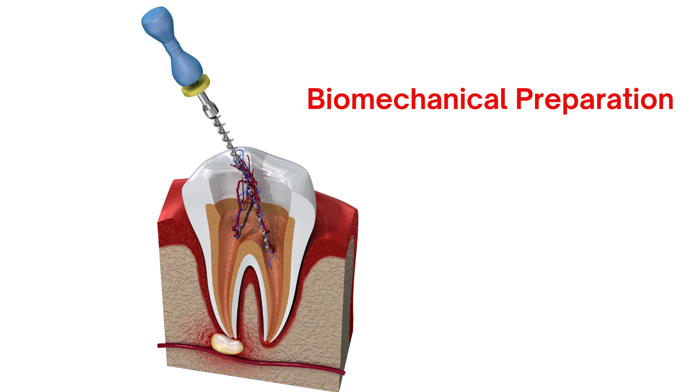 Root Canal Treatment for Dental Students